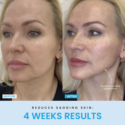 Lift - Smooth Illuminate Your Skin